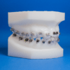 3D Indirect Bonding Ordont