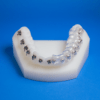 3D Indirect Bonding Ordont