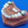 Basic Tongue Guard Ordont