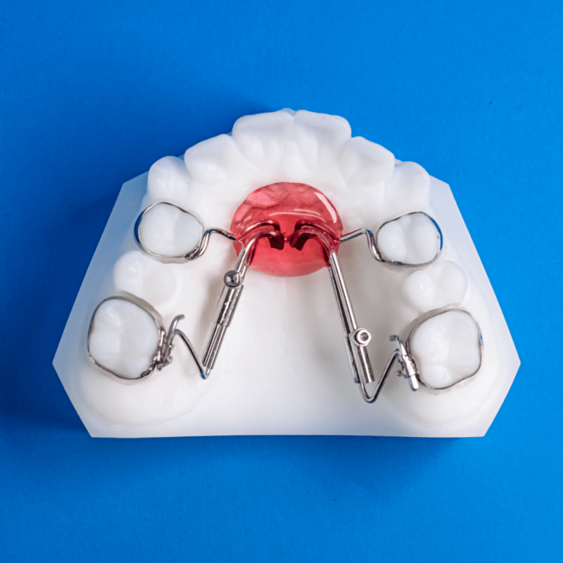 Haas - Ordont Orthodontic Appliance Lab