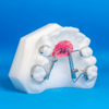 Distal Jet