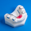 Distal Jet