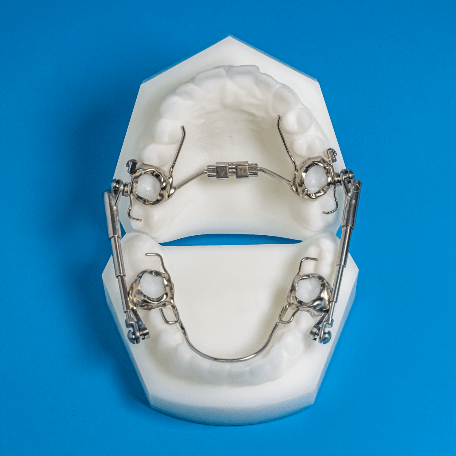 Specialty M4 Herbst Ordont Orthodontic Appliance Lab
