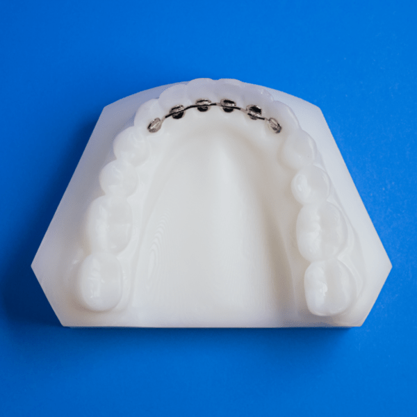 Mesh Fixed Lingual Retainers Ordont