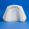 Mesh Fixed Lingual Retainers Ordont