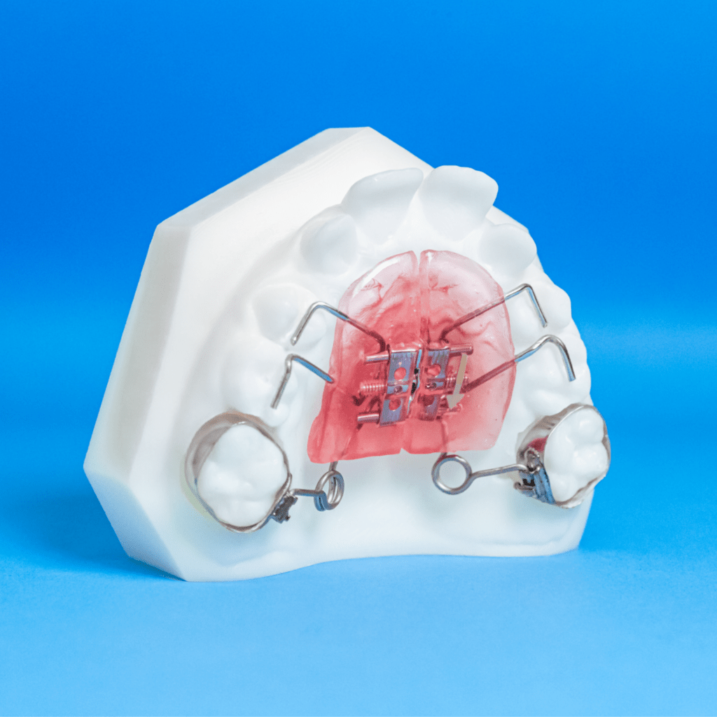 Pendex - Ordont Orthodontic Appliance Lab