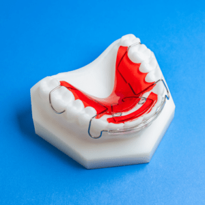 Super Modified Spring Retainer