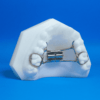 Upper RPE Ordont