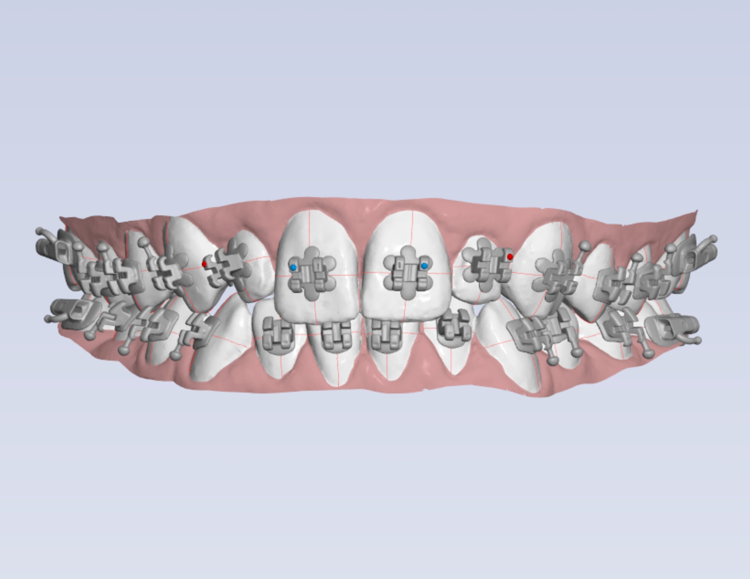 Wild Smiles x SA IDB orthodontic dental laboratory