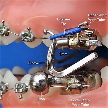 mara-ordont-orthodontic-appliance-lab